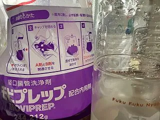 大腸内視鏡検査の備忘録