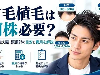 自毛植毛は何株必要？M字・生え際・頭頂部…