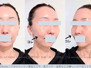 最近のアレコレ＆右頬に謎の脂肪？？肉を発…