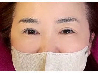 年齢によるお目元のお悩みなら、ぜひフェリ…