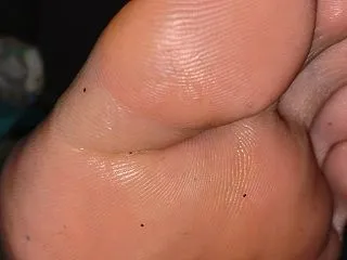 親指の外側が気になる