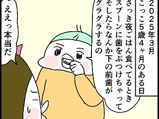 （娘５歳４ヶ月）こっこ、ちょっと早めに歯…
