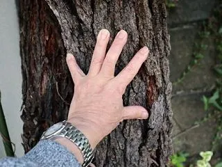 ３１歳になるユーカリ