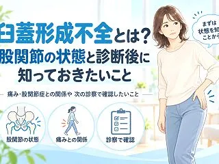 臼蓋形成不全とは？股関節の状態と診断後に…