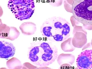 質問集17a）寛解状態には3段階がある/…