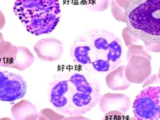 質問集17a）寛解状態には3段階がある/…