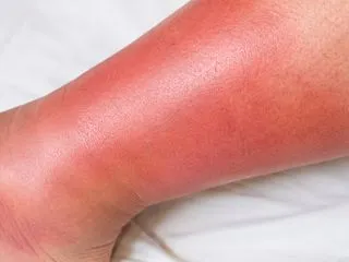 柱の一人になった