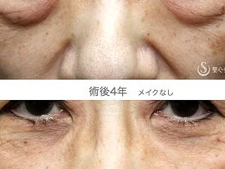 術者の私を信じてください（4年後）