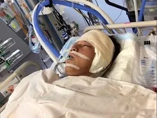 「好きな俳優さん…」脳出血で即入院、開頭…