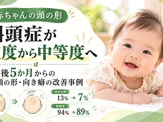 赤ちゃんの斜頭症が重度から中等度へ｜生後…