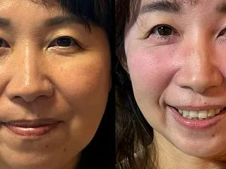 技術の高い施術を 受けると今まで 見られ…