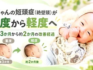 赤ちゃんの短頭症（絶壁頭）が重度から軽度…
