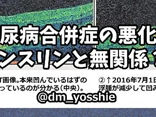 糖尿病ネットワーク「糖尿病合併症の悪化は…