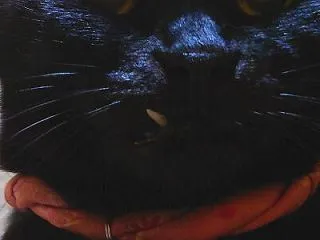 【傾き始めた右下の犬歯】 歯周病 No.…