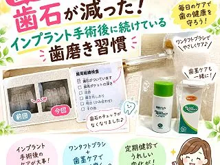【歯医者の定期健診】歯石が減った！インプ…