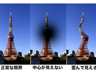 紹介先の病院は医師不足、慌てて探す加齢性…