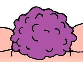 【衝撃の事実】健康な人でも「がん細胞」が…