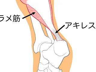 アキレス腱の違和感(/_;)