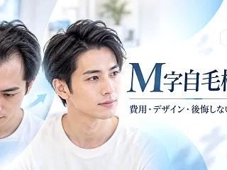 M字の自毛植毛は何株必要？費用相場・効果…