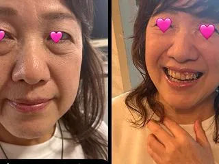 大人の可愛さ爆誕‼️目の下のたるみとふく…