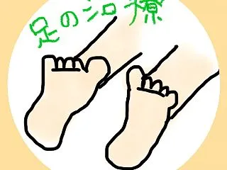 下肢静脈瘤、血管焼灼術のその後