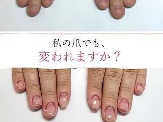 深爪だからネイルサロンに行けない？人前で…