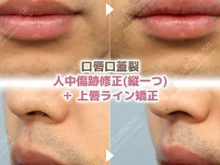 メイクで隠せない男性だからこそ。 口唇口…