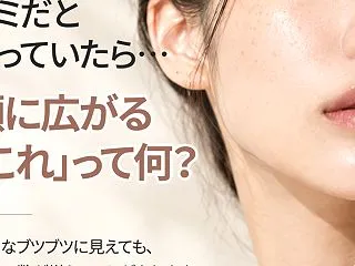 扁平疣贅治療