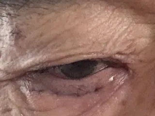 今日も眼科クリニックへ行く