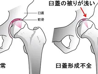 股関節が痛い⁉