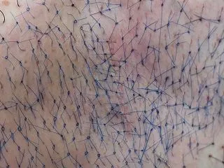 Threadsを見て大阪から来院 : ワ…