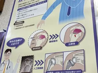 ジクトルテープ初体験