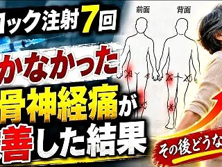 ブロック注射７回効かなかった坐骨神経痛が…