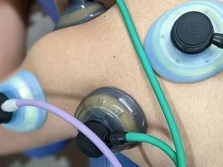 五十肩に低周波治療器は効く？使う前に知り…