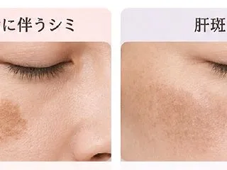 美容医療、何から始めればいい？