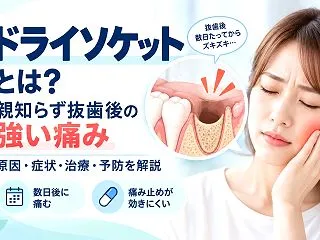 ドライソケットとは？親知らず抜歯後の激痛…