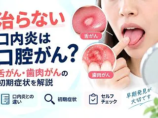 舌がん・歯肉がんの初期症状｜口内炎との違…