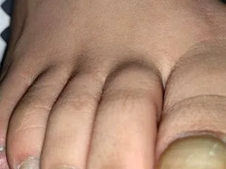 定期的な爪のケア