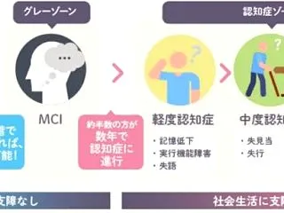 認知症の分かれ目？