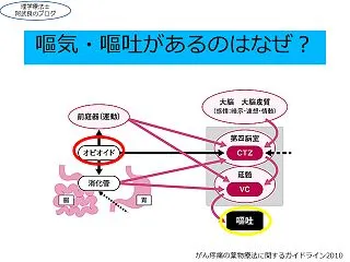 意外に知らない!!術後の嘔吐はなんで起こ…
