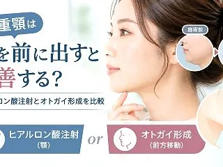 二重顎は顎を前に出すと改善する？ヒアルロ…