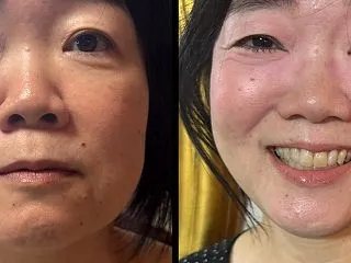 大人の涙袋と肌の質感〜人工的ではない美し…