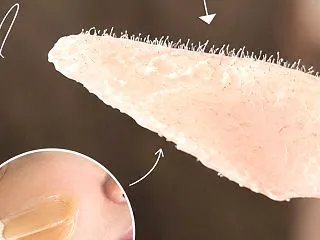フェイシャルワックス脱毛