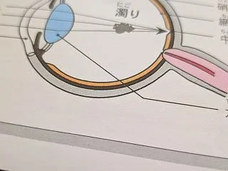 眼の異変
