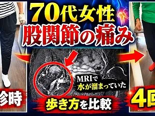 【４回目】70代女性 股関節痛 初診時と…