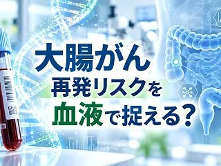 大腸がんの再発リスクを血液検査で早期把握…