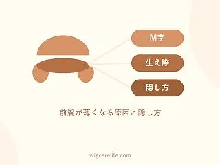 女性のM字・生え際の薄毛｜前髪が薄くなる…